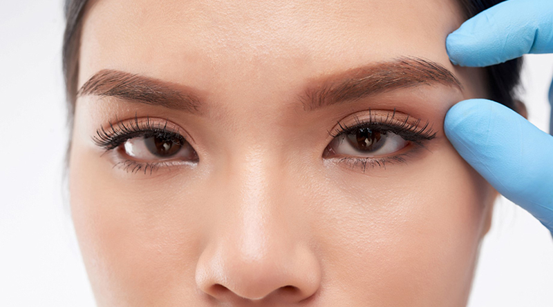 ศัลยกรรมยกหางตาซ่อนแผลใต้คิ้ว