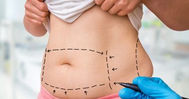 ทำโปรแกรมดูดไขมันหน้าท้องที่ไหนดี? เช็กปัจจัยก่อนปั้นหุ่นสวย ทำโปรแกรมดูดไขมันหน้าท้องที่ไหนดี