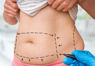 ทำโปรแกรมดูดไขมันหน้าท้องที่ไหนดี? เช็กปัจจัยก่อนปั้นหุ่นสวย ทำโปรแกรมดูดไขมันหน้าท้องที่ไหนดี