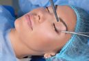 ทำไมศัลยกรรมหนังตาตกที่ Sky Clinic ถึงเป็น ตัวเลือกที่น่าสนใจ ศัลยกรรมหนังตาตก